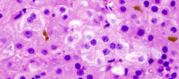 Microscope view of bacteria.