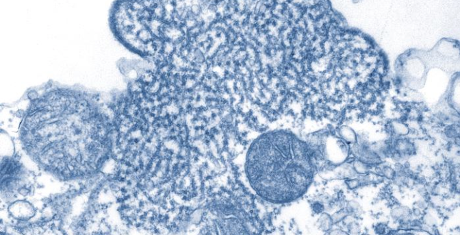 Bacteria