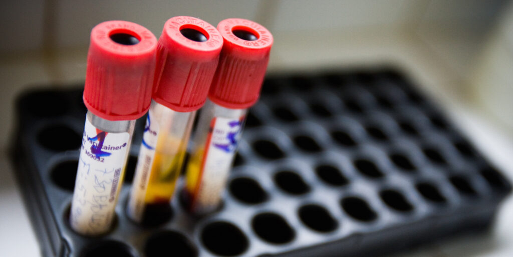 Vials of medicine